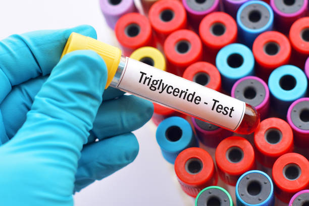 Triglycerides test